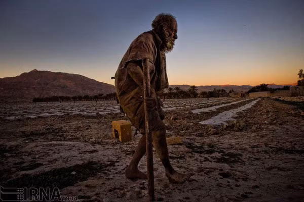 Vì không tắm nhiều năm nên làn da của ông Amoo Hadji phủ một lớp đất bẩn dày đặc như bùn. Ông cho rằng, việc tắm rửa khiến ông bị yếu đi và từ đấy, ông nói không với nước.