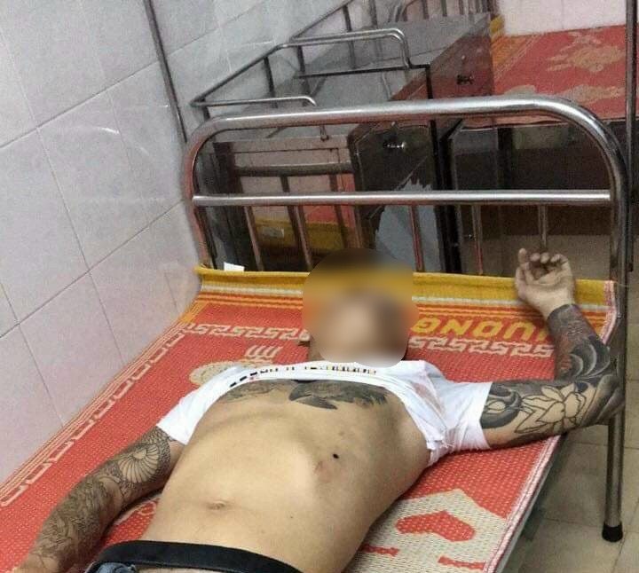 Khanh Hoa: Nguyen nhan vu no sung trong dem khien mot nguoi tu vong-Hinh-2