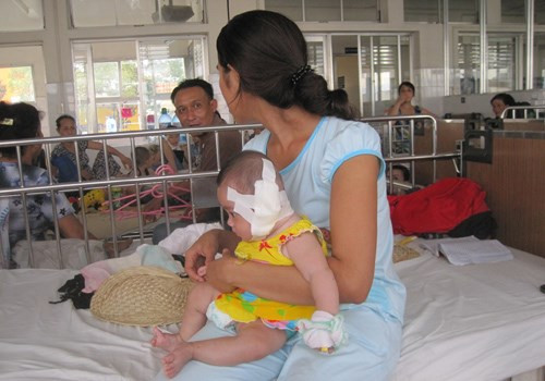 Khi tiến hành phẫu thuật, các bác sỹ đã gắp khoảng 50 con giòi ra khỏi cơ thể bé N. Do phát hiện muộn nên giòi đã ăn len lỏi khắp nơi trong vành tai và ăn mất ống tai. Vành tai bị hoại tử lởm chởm khiến sức nghe của bé N giảm từ 20 đến 40%. (Ảnh:Tinmoi).