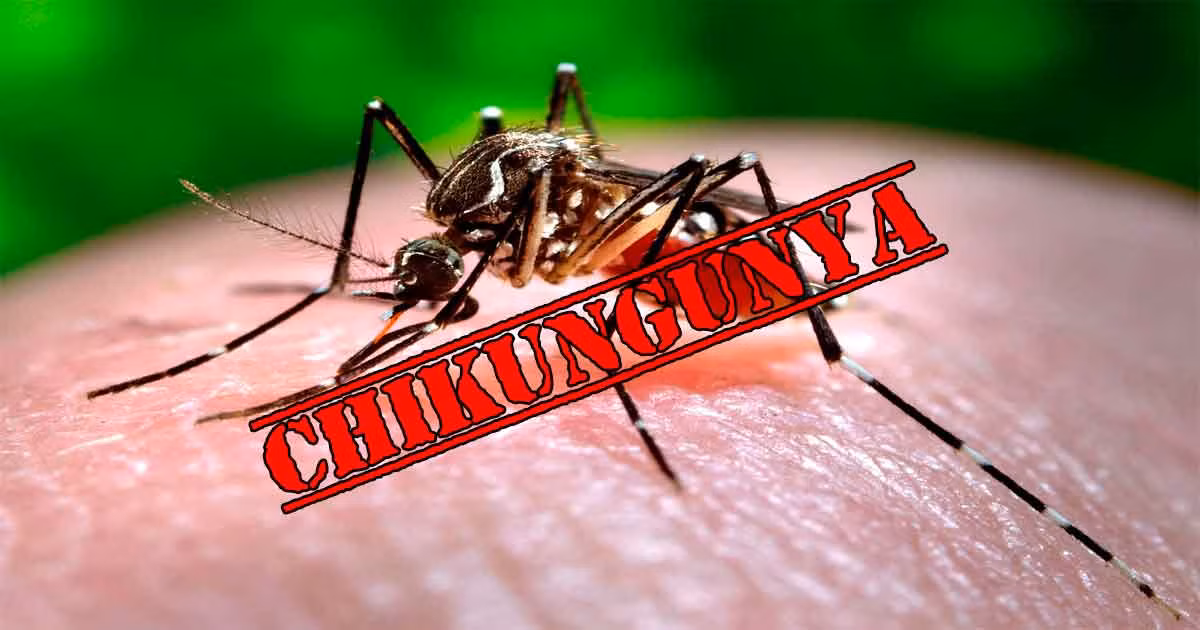 Cũng như bệnh sốt xuất huyết, bệnh sốt Chikungunya chưa có vaccine phòng bệnh và thuốc điều trị đặc hiệu. Khi bị mắc bệnh, biện pháp điều trị chỉ tập trung vào việc giải quyết triệu chứng và biến chứng.