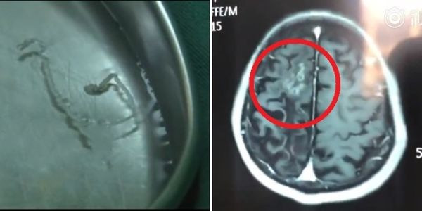 Nguoi dan ong dau dau 30 nam, ta hoa... thu 