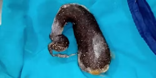 Chuyện lạ độc: Bé gái ăn cả cân tóc, lý do nhện hung dữ... Chuyen la doc: Be gai an ca can toc, ly do nhen hung du...