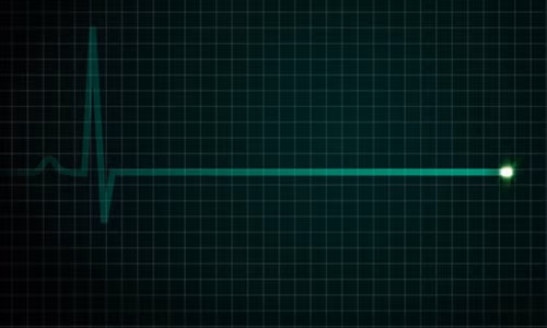 Bat ngo: Su song van tiep dien 2 ngay sau khi con nguoi chet-Hinh-2