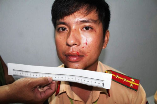 Nhom thanh nien phe ma tuy gia danh canh sat hinh su, tan cong CSGT-Hinh-2