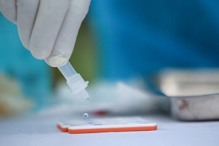 Vu thoi gia kit test COVID-19: Cty Viet A trung thau “khung” o tinh nao?-Hinh-2