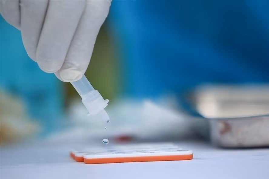 Vu thoi gia kit test COVID-19: Cty Viet A trung thau “khung” o tinh nao?-Hinh-2