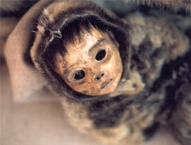 Am anh anh mat cua xac uop be trai 6 thang tuoi bi chon song theo me-Hinh-9