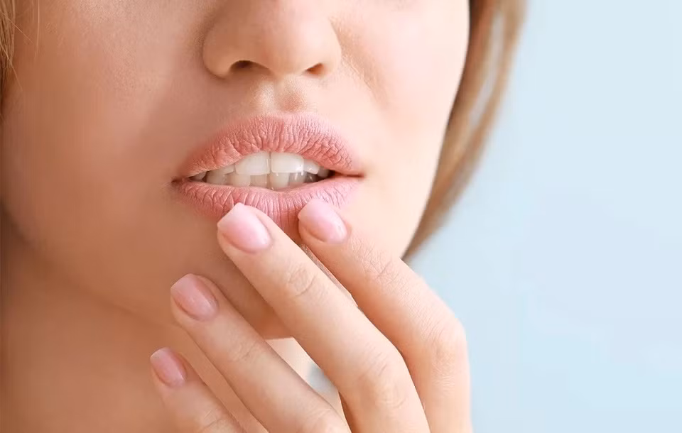 Môi khô và chảy máu: Theo NDTV, môi nứt nẻ hoặc khô là tình trạng phổ biến đặc biệt trong mùa lạnh. Tuy nhiên, vào những mùa khác, môi khô, hay bị chảy máu lại cảnh báo một số vấn đề sức khoẻ như mất nước, dị ứng hoặc phản ứng với thuốc, chẳng hạn steroid. Một vấn đề sức khỏe nghiêm trọng hơn có thể là suy giáp, gây tăng cân, mệt mỏi và dễ bị cảm lạnh. Nó cũng có thể đi kèm với tình trạng đi tiểu thường xuyên, khát nước và nhìn mờ. Ảnh: Tratenor.