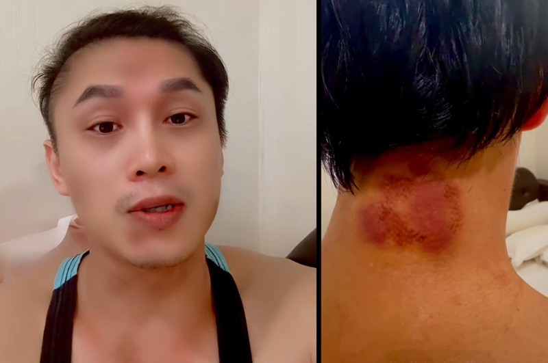 Hiện tại, sức khỏe của Du Thiên đã ổn định. Tuy nhiên, nam ca sĩ bị tung tin đồn qua đời. Ảnh: FBNV.