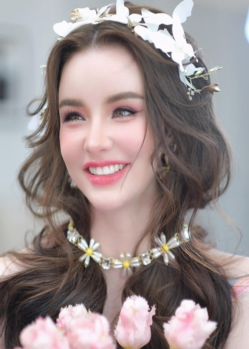 Jessie Vard sở hữu nụ cười toả nắng nhờ niềng răng.