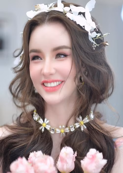 Jessie Vard sở hữu nụ cười toả nắng nhờ niềng răng.