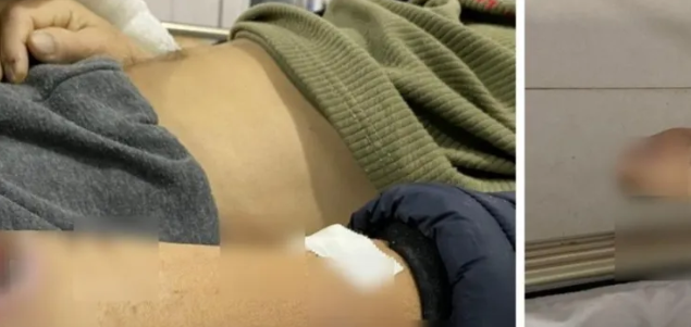  Bắt nguyên đội trưởng, đội phó công an huyện: Chiều 10/11, Viện Kiểm sát nhân dân tối cao cho biết vừa Quyết định khởi tố bị can, Lệnh bắt bị can để tạm giam đối với hai người nguyên là đội trưởng, đội phó Đội Cảnh sát thi hành án hình sự và hỗ trợ tư pháp - Công an huyện Vũ Thư (tỉnh Thái Bình). Hai nguyên cán bộ Công an huyện Vũ Thư bị bắt liên quan đến cái chết bất thường, nghi bị áp dụng nhục hình của 1 nghi phạm. 