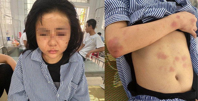 Theo chia sẻ của chị L., chị bị anh V.V.T (27 tuổi, trú tại địa phương) lẻn vào nhà, đánh đập dã man. Nguyên nhân được cho là vì T. có tình cảm đơn phương với chị L. Việc theo đuổi suốt một thời gian dài nhưng không được chị L. chấp nhận, đã khiến T. cảm thấy bực tức, ghen tuông vô cớ khi thấy người thiếu nữ này đi chơi với bạn bè.