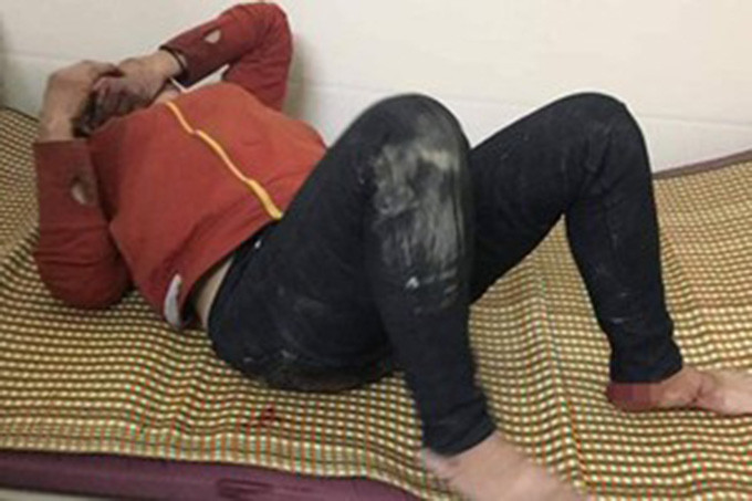 Trước đó, ngày 29/10, người dân thị trấn Nam Đàn, Nghệ An phát hiện một người phụ nữ nằm gục ở góc chợ với nhiều vết thương nghi bị bạo hành. Sau đó, người phụ nữ này được đưa vào bệnh viện thăm khám.