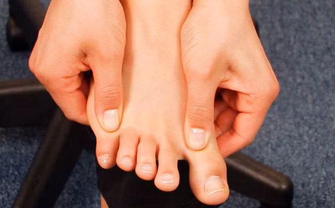 Ung thư kẽ ngón chân: Nếu kẽ ngón chân của bạn thường xuyên xuất hiện những vết thương lâu không lành, hoặc xuất hiện đốm đen bất thường thì hãy tới bệnh viện để kiểm tra vì đó có thể là dấu hiệu của bệnh ung thư. Ảnh: Baophunu.