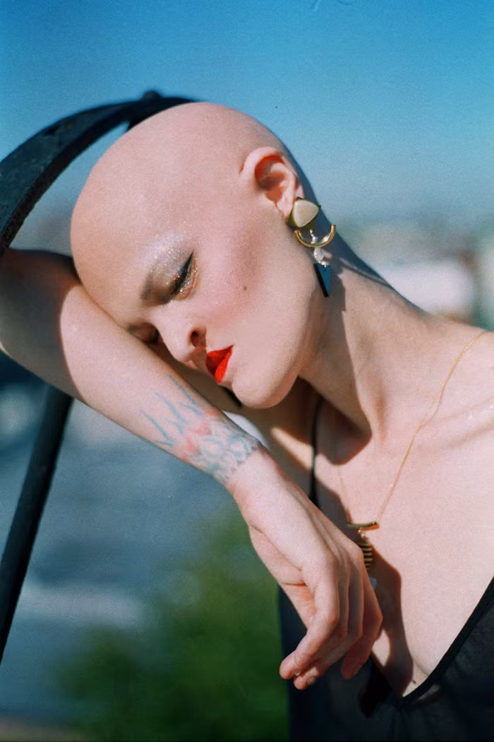 Melanie Gaydos 28 tuổi, người Mỹ. Cô mắc phải một căn bệnh quái dị là một rối loạn di truyền được gọi là dysplasia ectodermal ngay từ khi mới chào đời.