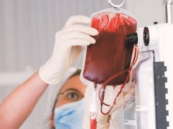 Ung thư thận có 5% tỷ lệ mắc do di truyền. Ung thư thận có thể gây đau hoặc tức vùng lưng hông, tiểu ra máu, khối u ở bụng, thiếu máu, mệt mỏi, sốt. Ảnh: HHTMTW.