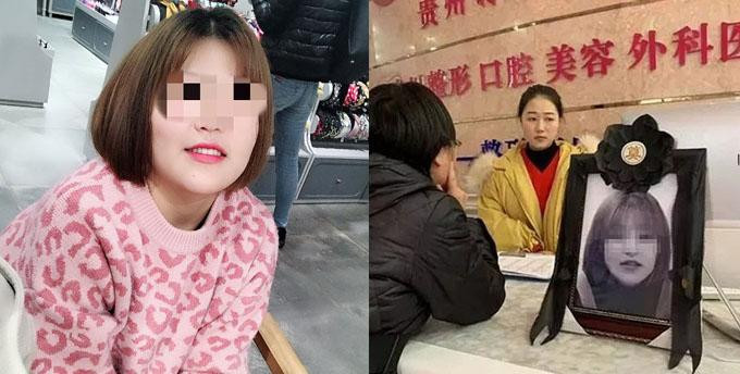 Co gai 19 tuoi tu vong khi nang mui lam dep