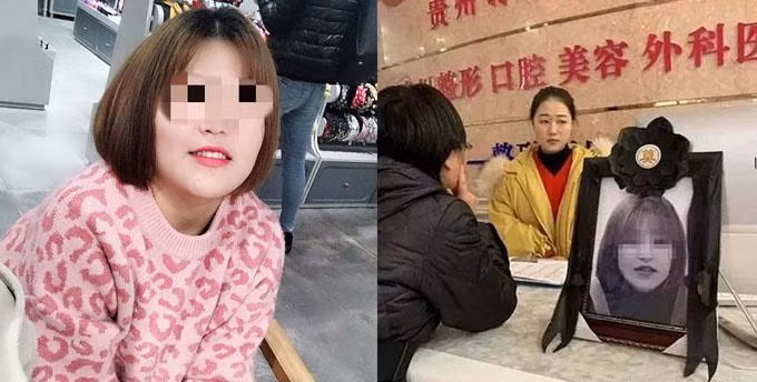 Co gai 19 tuoi tu vong khi nang mui lam dep