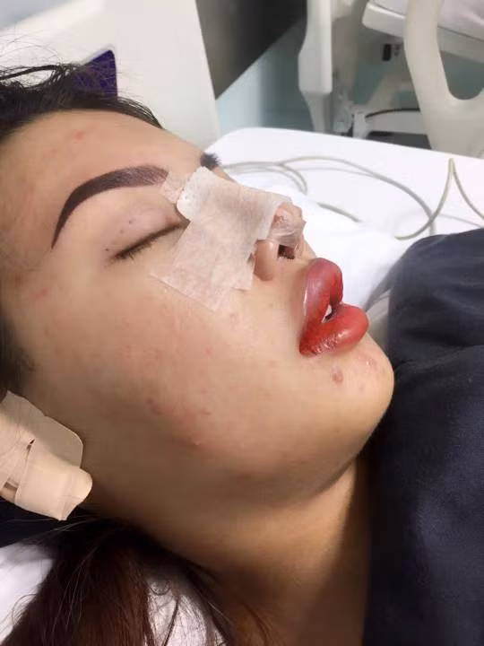 Trước đó, bà mẹ đơn thân khiến dư luận xôn xao khi chia sẻ những hình ảnh bản thân từng bị chê xấu như Thị Nở hóa thiên nga sau khi chi hơn 200 triệu đồng "dao kéo" làm đẹp.