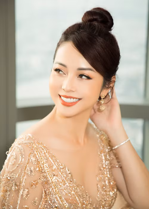 Tai nạn khiến người đẹp phải khâu 10 mũi ở trán sâu 3cm.