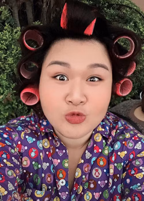 Thủy Tiên từng trải qua 2 lần đại phẫu hút mỡ. Được biết, chi phí cho 2 lần là 100 triệu đồng.