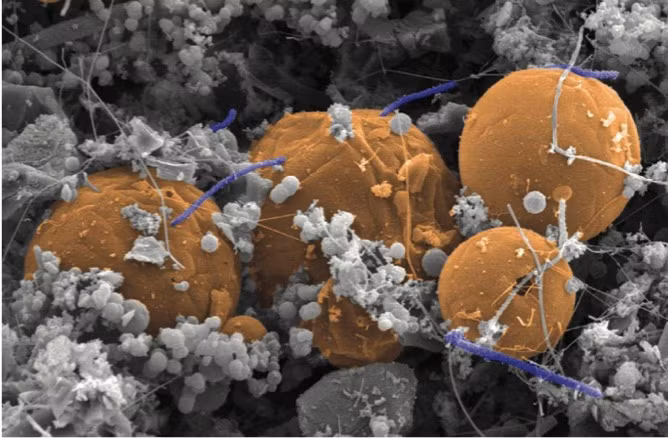 Desulforudis audaxviator là một loại vi khuẩn đơn loài chỉ được tìm thấy trong các mẫu nước lấy dưới lòng đất ở Mỏ vàng Mponeng. Ảnh: Wiki