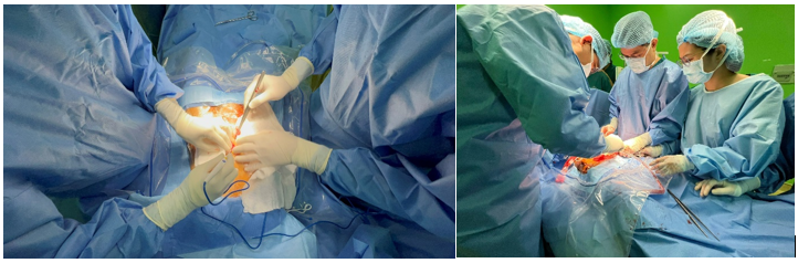 Co gai 22 tuoi bi di tat bam sinh phuc tap