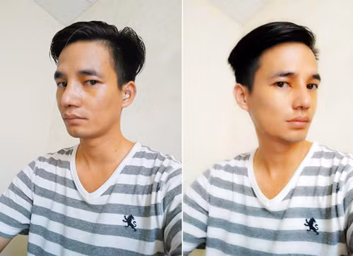 Được biết, chàng trai Hải Dương vẫn đang ở TP.HCM thực hiện nốt ca cắt mỡ thừa ở mí mắt và làm răng, hoàn thành ca “trùng tu” nhan sắc đầu tiên.