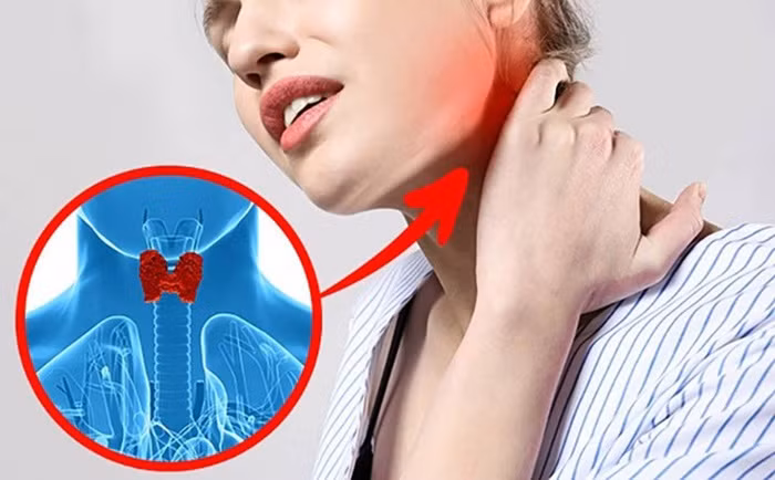 8 dau hieu canh bao som benh tuyen giap o phu nu