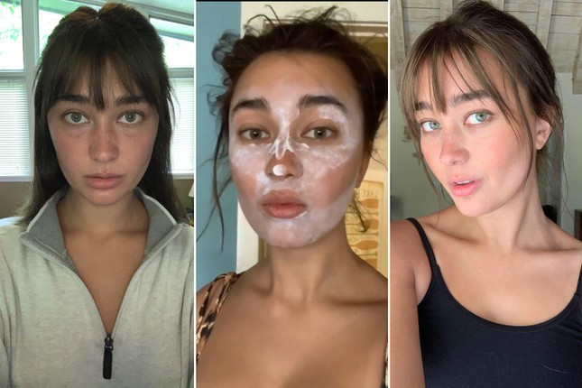 Nhung chieu cham soc da tren TikTok tuyet doi khong nen thu