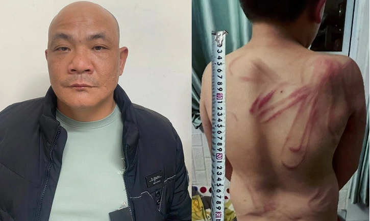  Cha dùng dây nịt cột cổ con "dắt đi như dắt chó": Tối 19/10/2022, sau khi đi nhậu về, Nguyễn Thành Luân (tên thường gọi Luân "chùa", 37 tuổi, trú tại chung cư Mẫu Tâm, P.5, TP Đà Lạt, tỉnh Lâm Đồng) nghe vợ nói con trai là cháu N.A.H. (10 tuổi) lấy cắp 100.000 đồng nên đã dùng tay đánh vào mặt con. Sau đó Luân dùng dây nịt đánh cháu H. nhiều lần và bắt bò từ cầu thang ra cửa, bắt cháu H. phải dùng miệng mô phỏng chó sủa. Chưa dừng lại ở đó, Luân còn cột dây nịt vào cổ con, giật nhiều cái và "dắt đi như dắt chó", bắt cháu H. bò ra ngoài nhà và dắt đi trong hành lang chung cư. Trong khi dắt đi, ông này nhiều lần dùng chân đá vào người và dùng tay tát vào mặt con. Ngày 3/11, Công an TP Đà Lạt đã khởi tố Luân để điều tra. 