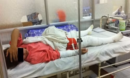 Binh Duong: Tuoi xang dot lo banh mi, 4 nguoi bong nang