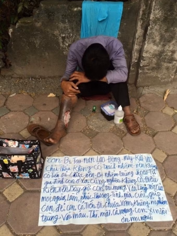 Lat mat that thanh nien gia “ngat vi doi” de xin an-Hinh-5