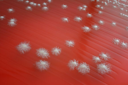 Viêm âm đạo. Ra máu có thể do âm đạo bị nhiễm trùng hoặc nhiễm nấm. Nếu nghi ngờ bị viêm âm đạo, bạn nên đi khám để bác sĩ kiểm tra xem đó là viêm loại nào, có cần điều trị không… Tùy thuộc vào từng loại viêm, bạn có thể được bác sĩ chỉ định uống kháng sinh hoặc dùng thuốc chống nấm.