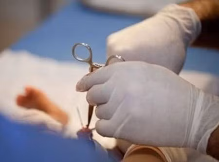 Chứng minh sự trưởng thành bằng cách ăn da bao quy đầu. Được biết đến như tục lệ kinh dị, tục ăn bao quy đầu của người Mardudjara, một dân tộc thiểu số tại Australia khiến bất kể ai cũng phải rùng mình khi nhắc tới. Đây được coi là 1 trong những phong tục sex lạ lùng trên thế giới.