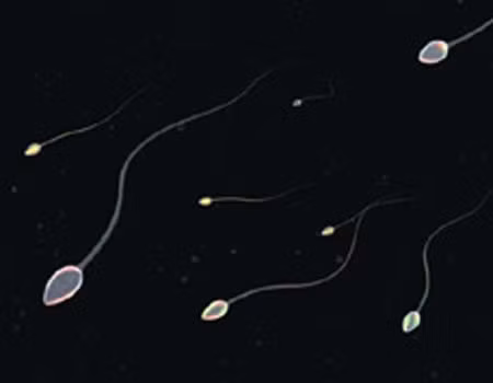 Nguyên nhân gây xuất tinh ngược dòng là do tổn thương các sợi thần kinh giao cảm trung gian vùng cổ bàng quang và cơ thắt tuyến tiền liệt. Một số nguyên nhân gây tổn thương các cơ ở bàng quang có thể do.