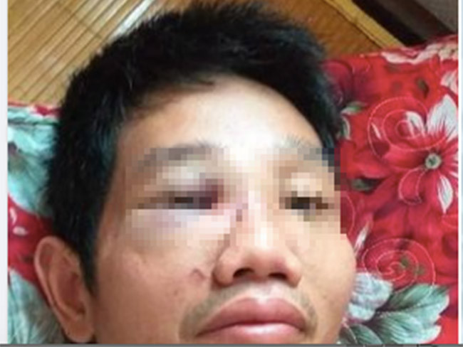 Mau thuan tai chot kiem dich, mot can bo bi danh nhap vien