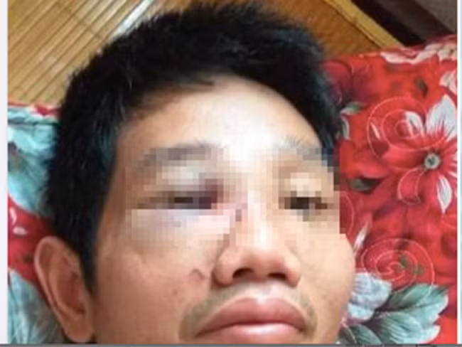 Mau thuan tai chot kiem dich, mot can bo bi danh nhap vien