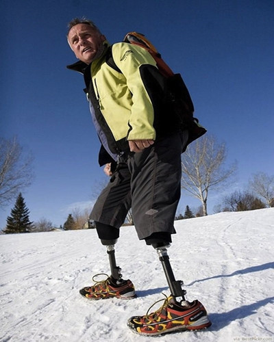 Năm 1982, Mark Inglis và Phil Doole đang leo núi Aoraki của New Zealand thì gặp bão tuyết nên buộc phải trú ẩn trong một hang động. Sau khi bão tan, hai người bị kẹt trong hang suốt 14 ngày mà không được sưởi ấm khiến chân tê cóng và buộc phải cắt bỏ đôi chân của chính mình.