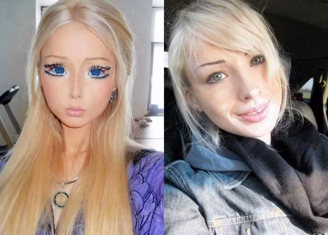 Valeria Lukyanova được mệnh danh là búp bê phiên bản đời thực hoàn hảo nhất thế giới. Valeria từng bị một nhóm côn đồ hành hung đến trọng thương chỉ vì trang điểm và ăn mặc quá giống Barbie. Tuy nhiên, sau khi loạt ảnh không son phấn của cô được công bố rộng rãi, mọi người không còn tung hô nhan sắc của nàng búp bê sống này. Ảnh: Daily Mail.
