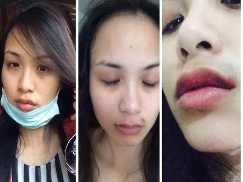 Hoa hậu Diễm Hương từng tố bị chồng cũ đại gia liên tục hăm dọa quấy rối và hành hung. Trước lời tố của Diễm Hương, chồng cũ của cô đã lên tiếng phủ nhận. Sự việc sau đó cũng được giải quyết trong im lặng. Ảnh: FBNV.