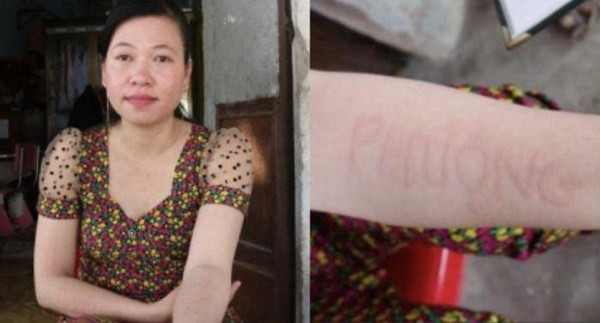 Co gai so huu lan da doc la, co the viet chu ve tranh-Hinh-2