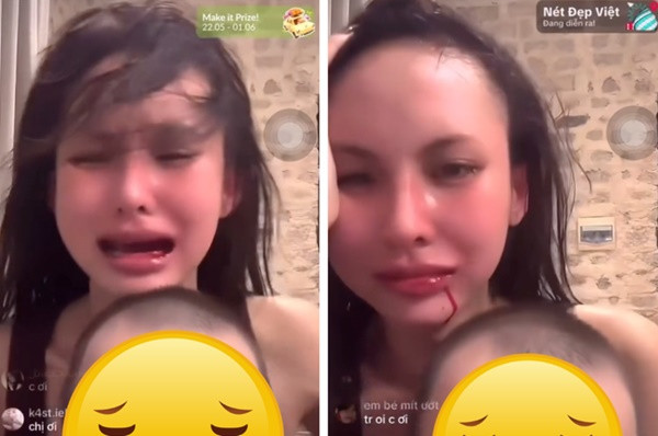 Vo Decao om con khoc va chay mau mieng tren livestream