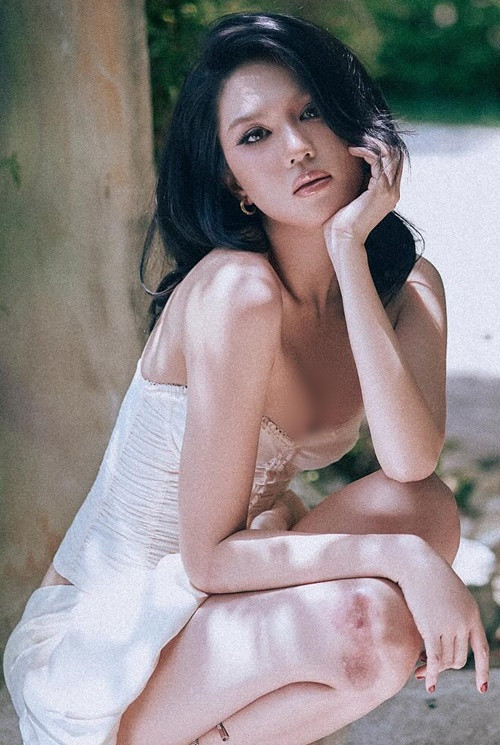 Ngọc Trinh chia sẻ, trước đây, nếu như có một vết sẹo nhỏ, cô coi đó là một chuyện không chấp nhận được, lo lắng ngày đêm. Tuy nhiên, giờ đây, cô cảm thấy những vết sẹo này chỉ là một chuyện nhỏ.