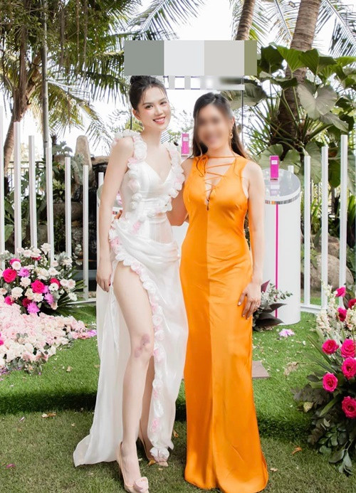 Ngọc Trinh không ngần ngại mặc gợi cảm để lộ sẹo lớn trên chân.