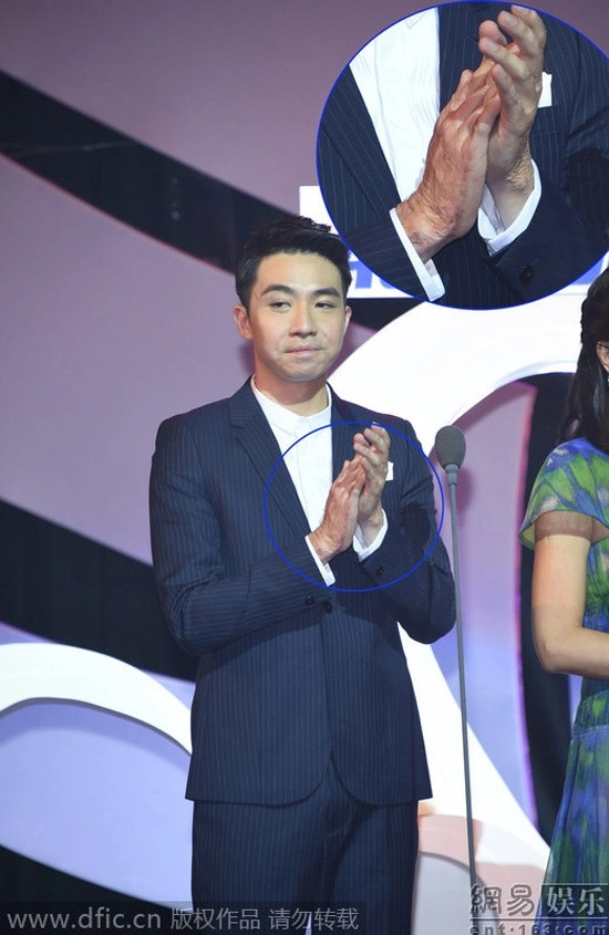 Sự chậm trễ này ảnh hưởng khá lớn đến những nam diễn viên như Du Hạo Minh bởi vắng bóng quá lâu và nhiều gương mặt trẻ đẹp xuất hiện.