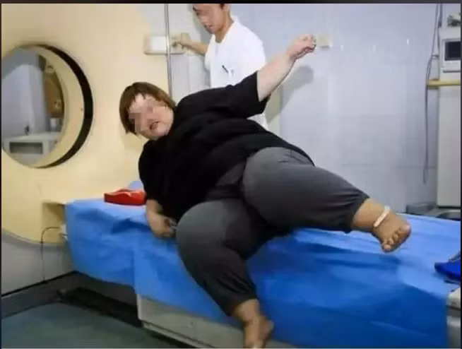 Ban đầu, cô gái ăn vài kikogam thực phẩm. Nhưng khi trở nên nổi tiếng, cô ăn nhiều lên, tới 10kg và hơn nữa. Cô bắt đầu phát trực tuyến hơn 10 giờ mỗi ngày và dần dần thu hút được một lượng lớn khán giả, cũng như nhận được nhiều quà tặng.