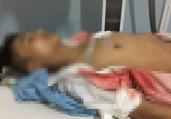 Nam sinh lop 11 bi ban dam vao nguc o cong truong