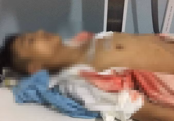 Nam sinh lop 11 bi ban dam vao nguc o cong truong